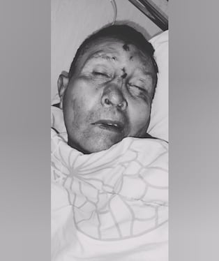 Buscan a familiares de paciente internado en situación de gravedad (Foto: Hospital Honorio Delgado Espinoza)