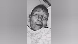 Buscan a familiares de paciente internado en el hospital Honorio Delgado en Arequipa