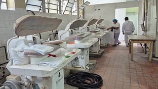 Hospital Honorio Delgado de Arequipa: Una década sin patrimonizar varios equipos