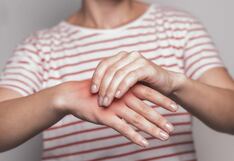 Invierno incrementa riesgo de mordeduras por araña casera en Perú, alerta el INS