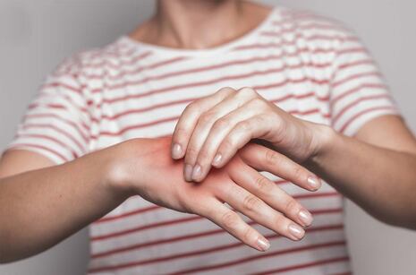 Invierno incrementa riesgo de mordeduras por araña casera en Perú, alerta el INS