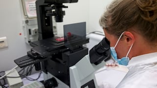 Francia detecta primer caso humano del virus Shamonda en paciente que falleció en Lyon