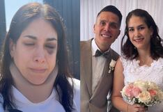 Ica: exalcaldesa Emma Mejía denuncia brutal agresión y justicia liberó a su esposo