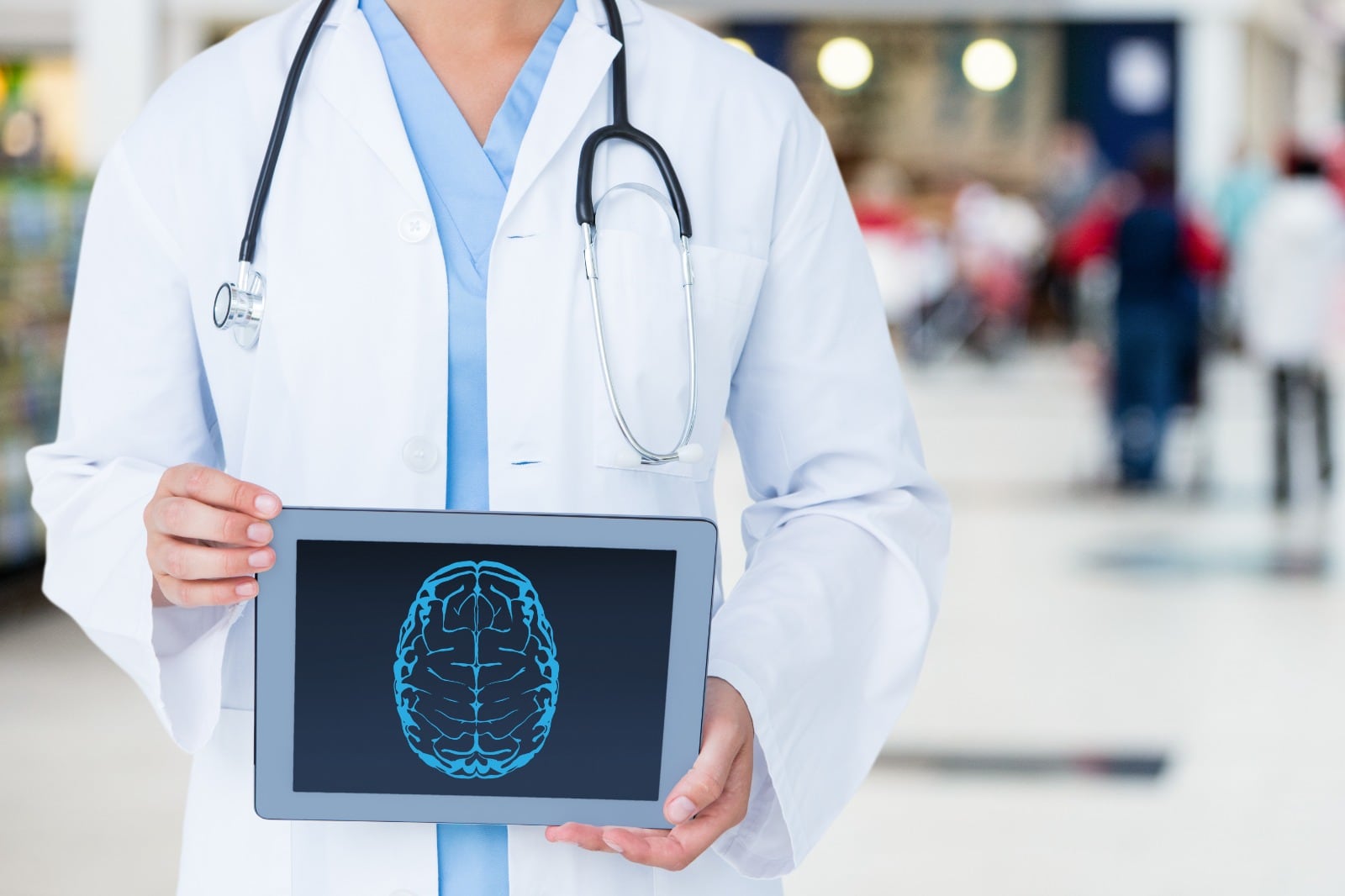 Los accidentes cerebrovasculares figuran entre las principales causas de muerte en el Perú. Expertos destacan la importancia de adoptar hábitos saludables para proteger el cerebro y prevenir enfermedades neurológicas.