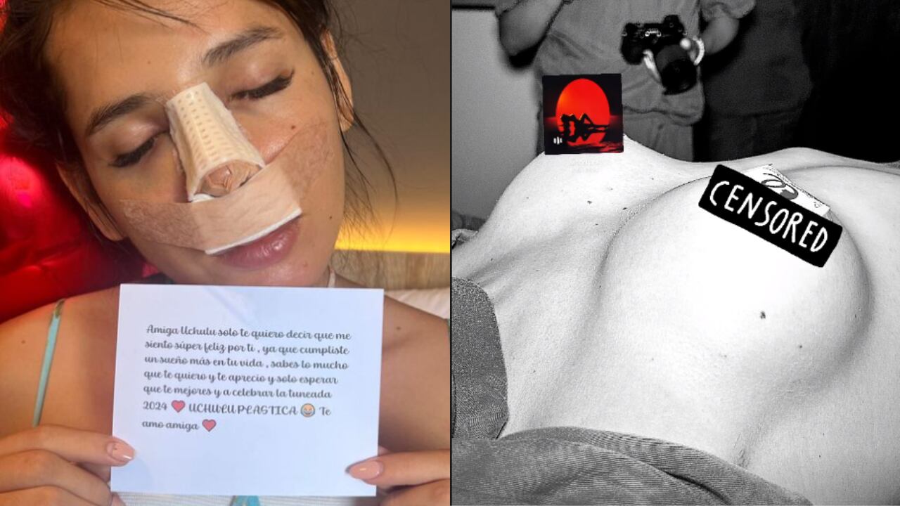La Uchulu se sometió a dos cirugías estéticas antes de navidad