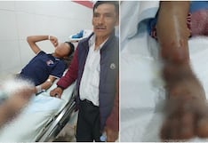 Víbora ataca a menor y veneno se prolongó rápidamente dejándolo en el hospital