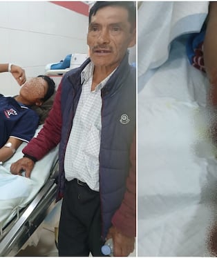 Víbora ataca a menor y veneno se prolongó rápidamente dejándolo en el hospital