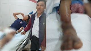 Víbora ataca a menor y veneno se prolongó rápidamente dejándolo en el hospital