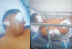 Ica: criminales intentan robar mototaxi a joven y lo acuchillan en el brazo y rostro en Salas Guadalupe