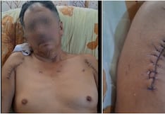 Nasca: víctima de ataque a balazos en Marcona solicita apoyo para continuar tratamiento médico