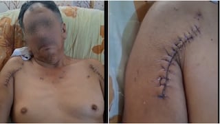 Nasca: víctima de ataque a balazos en Marcona solicita apoyo para continuar tratamiento médico