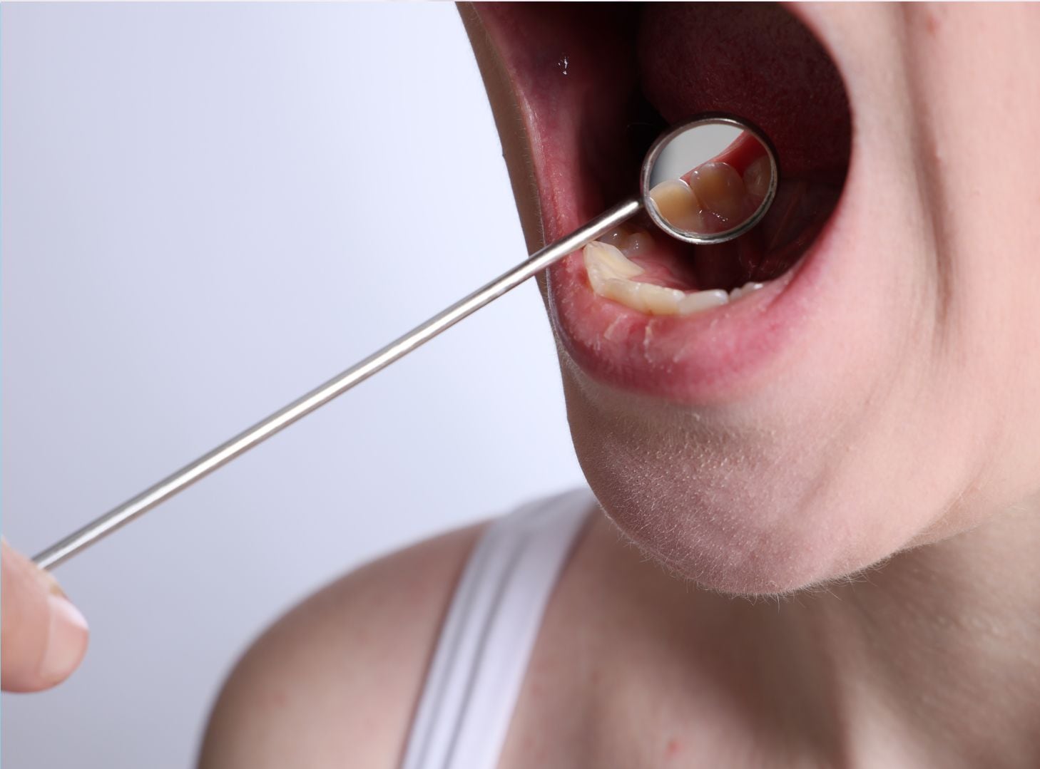 La enfermedad periodontal y los problemas cardiovasculares comparten factores de riesgo y mecanismos inflamatorios. Sangrado, inflamación o retracción de encías requieren evaluación odontológica, pero no diagnostican por sí solos una enfermedad cardíaca.