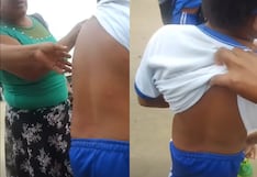 Piura: Colegiales sufren por picaduras de pulgas en Sullana
