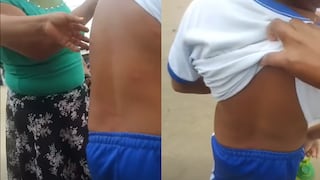 Piura: Colegiales sufren por picaduras de pulgas en Sullana