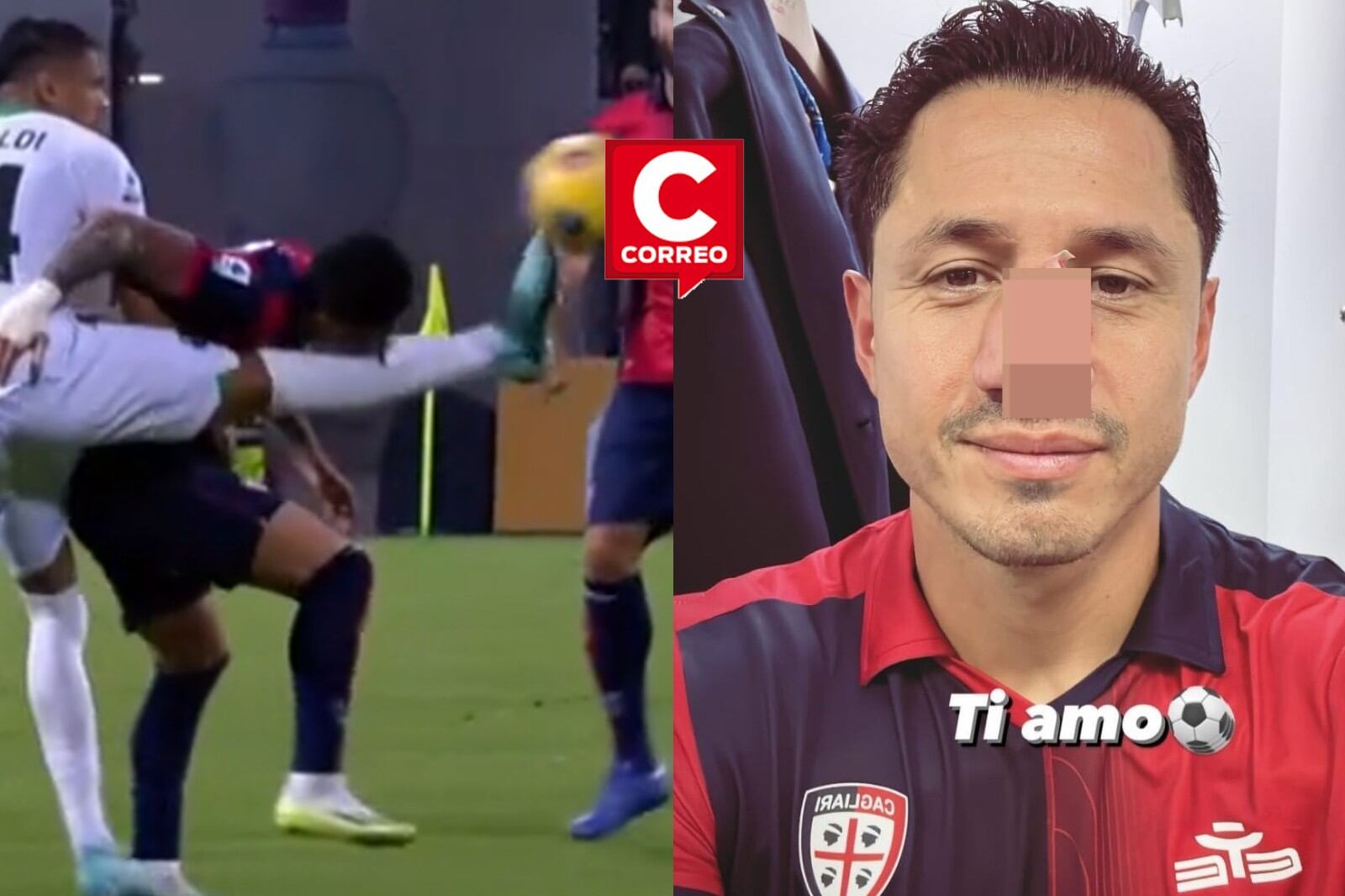 Lapadula y su nueva lesión en la nariz.