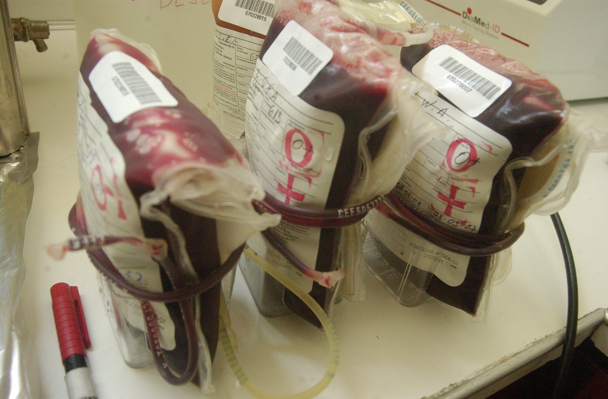 RECORRIDO POR LOS BANCOS DE SANGRE, HOSPITAL DANIEL SANCHEZ CARRION DEL CALLAO Y HOSPITAL ARZOBISPO LOAYZA DEL CERCADO DE LIMA, 01 MARZO DEL 2007
(FELIX INGARUCA ABAD/EL COMERCIO-PERU)