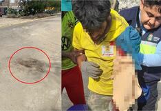 Ica: joven con habilidades diferentes casi pierde el brazo en camión compactador en Parcona