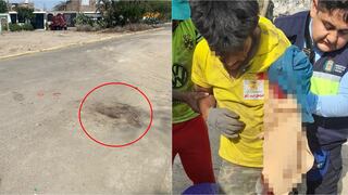 Ica: joven con habilidades diferentes casi pierde el brazo en camión compactador en Parcona