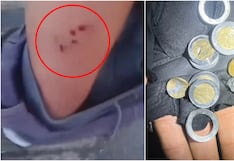 Ica: le disparan en la pierna y monedas en su bolsillo habrían reducen el impacto de la bala
