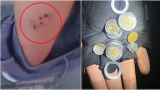 Ica: le disparan en la pierna y monedas en su bolsillo habrían reducen el impacto de la bala