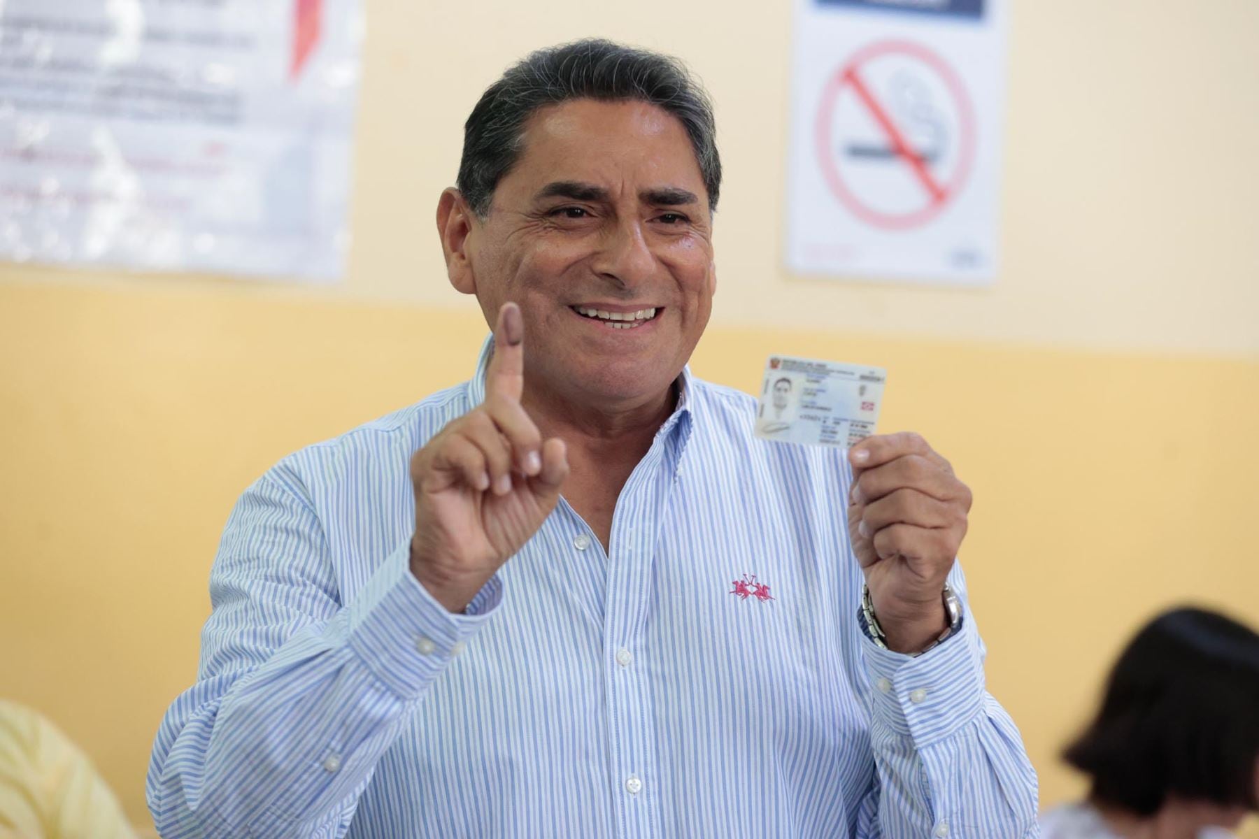Productor del imitador informó que la intervención se realizó ayer y que el artista retomará sus actividades cuando reciba el alta médica. Foto: Andina
