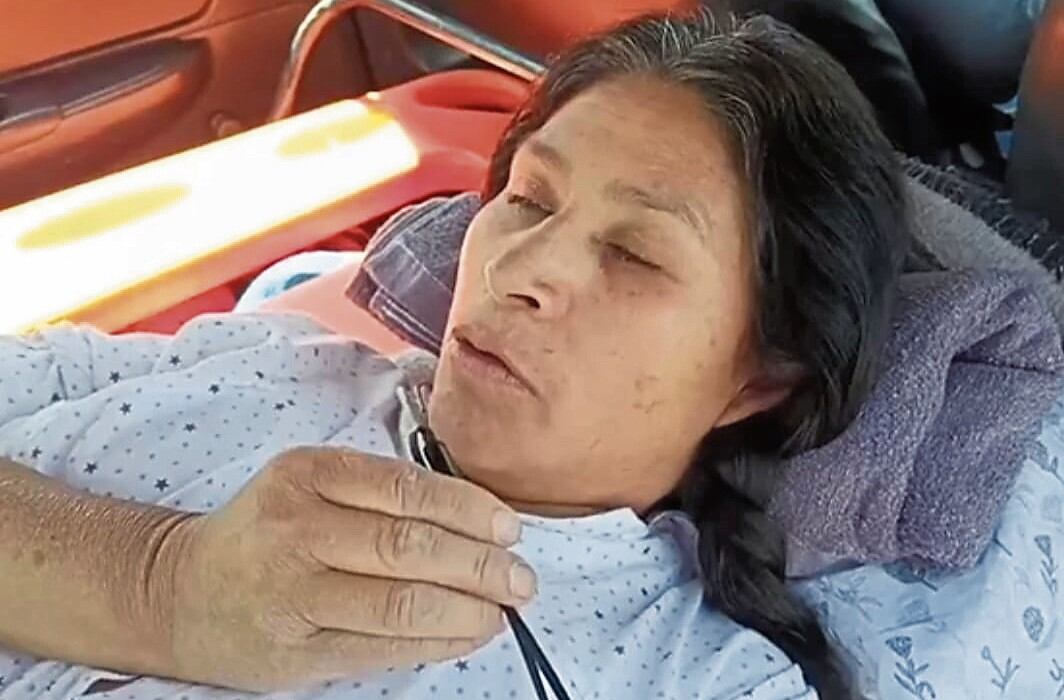 Eulalia Espirilla (Arequipa), madre de familia, no puede caminar. (Foto: Fanny Arotaipe/@photo.gec)