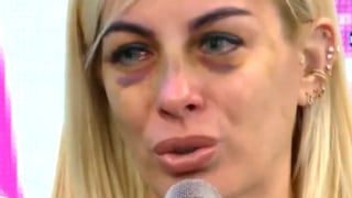 Dalia Durán revela que su familia está “destrozada” tras conocer agresión de John Kelvin (VIDEO) 