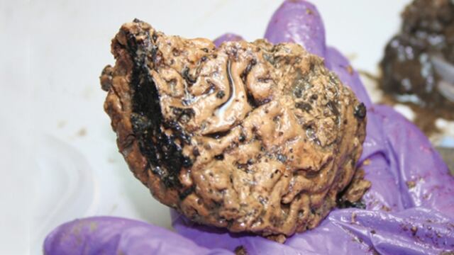 Hallan un cerebro humano de 2.600 años de antigüedad
