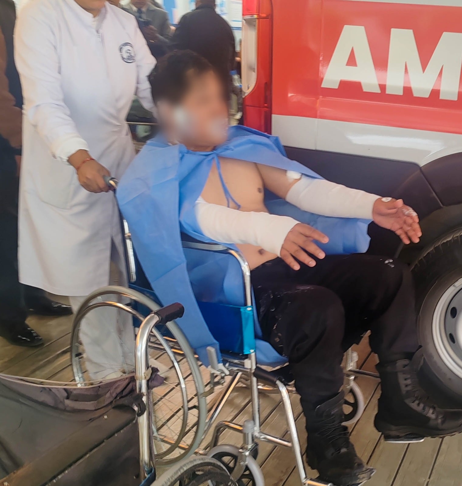 Huancayo: Salvaje ataque con combustible deja quemados a nueve servidores municipales