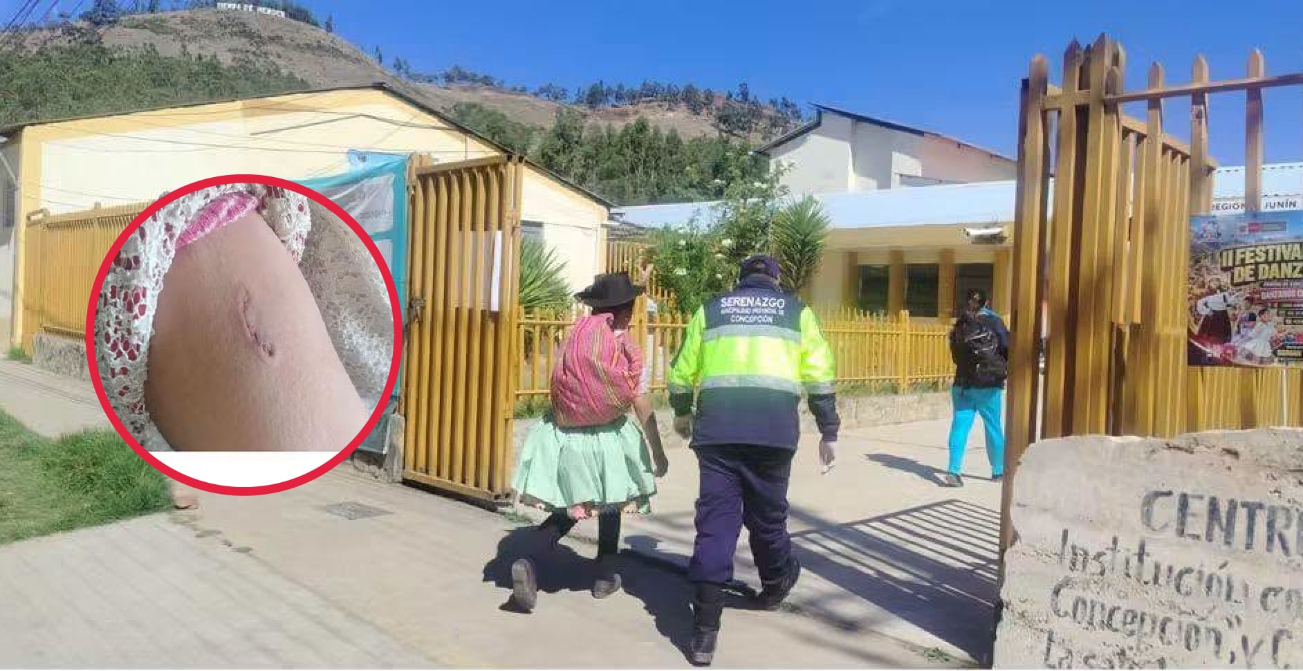 Concepción: adulta mayor termina herida tras ataque de perro