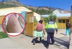 Concepción: adulta mayor termina herida tras ataque de perro