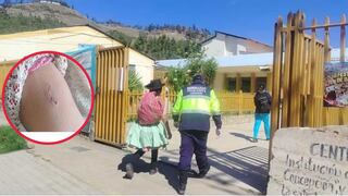 Concepción: adulta mayor termina herida tras ataque de perro