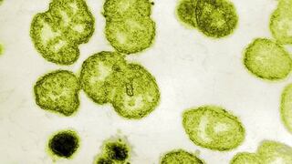Preocupación por aparición de gonorrea ultra resistente a antibióticos