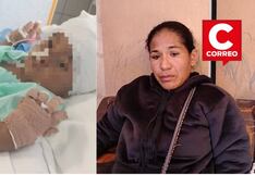 Ica: niño de 3 años podría perder cuatro dedos tras sufrir graves quemaduras en San Juan Bautista