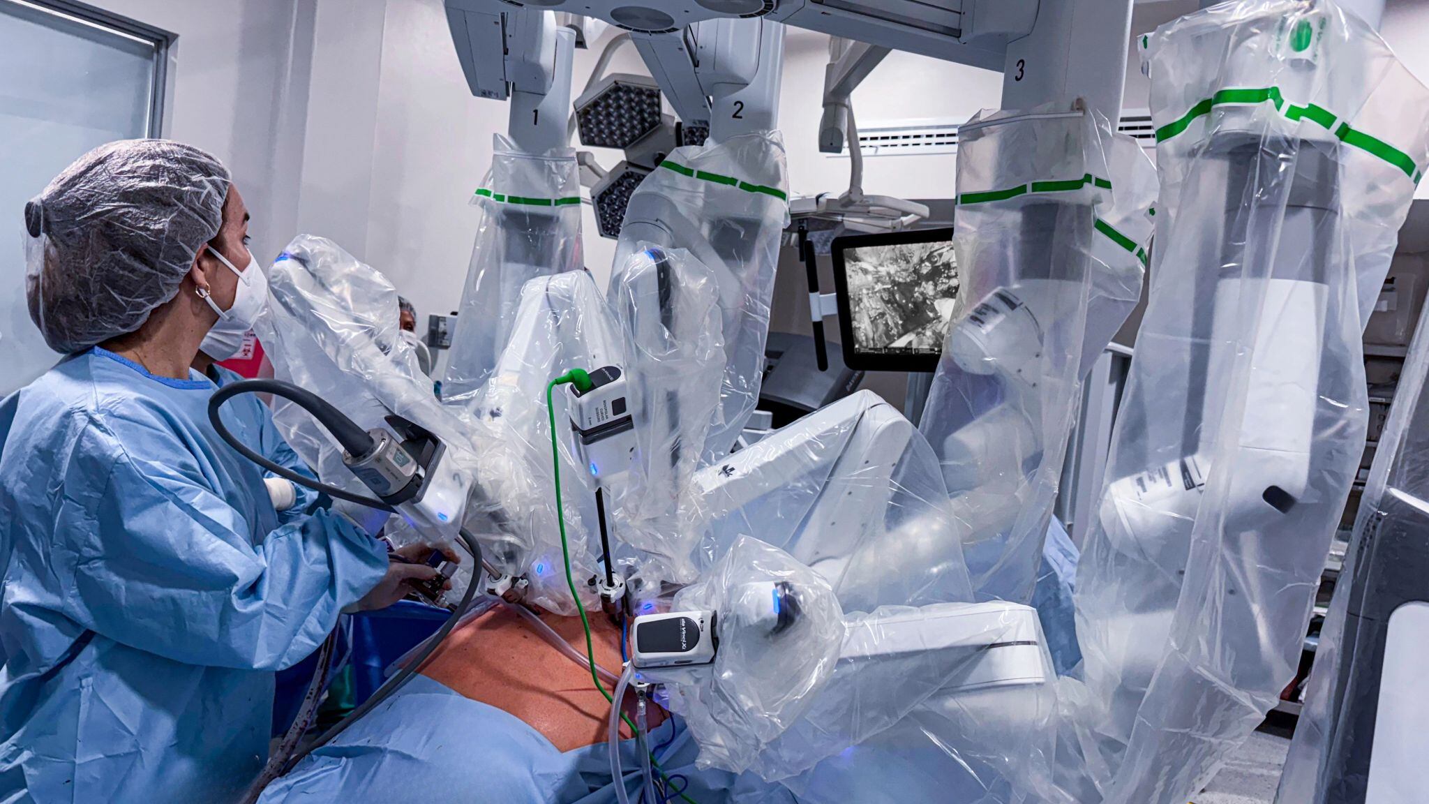 Aunque ya se realizan operaciones con asistencia robótica en hospitales peruanos, persisten creencias erróneas que generan temor en los pacientes. Expertos explican la realidad detrás de estos mitos.