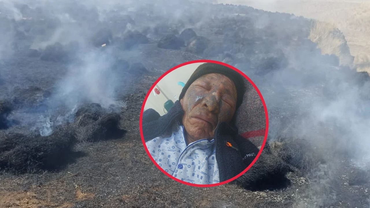 Incendio forestal en Puno: Comunero con graves quemaduras al intentar salvar a sus animales (VIDEO)