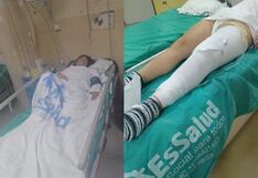 Ica: accidente laboral en fundo agrícola deja a trabajadora con graves fracturas