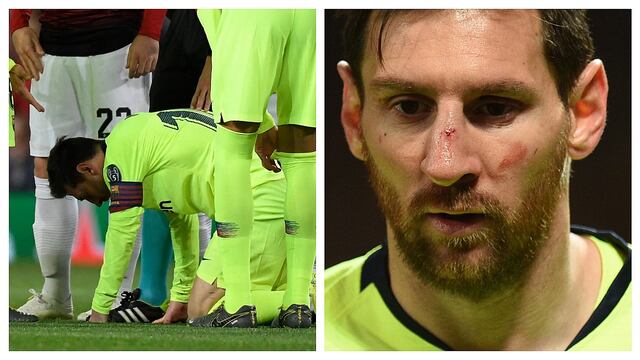 ​Manchester United vs Barcelona: Lionel Messi sufrió un corte durante partido (VIDEO)