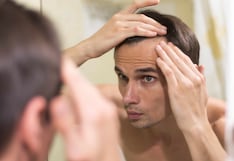 Calvicie masculina: causas frecuentes y cómo prevenirla con cuidado profesional