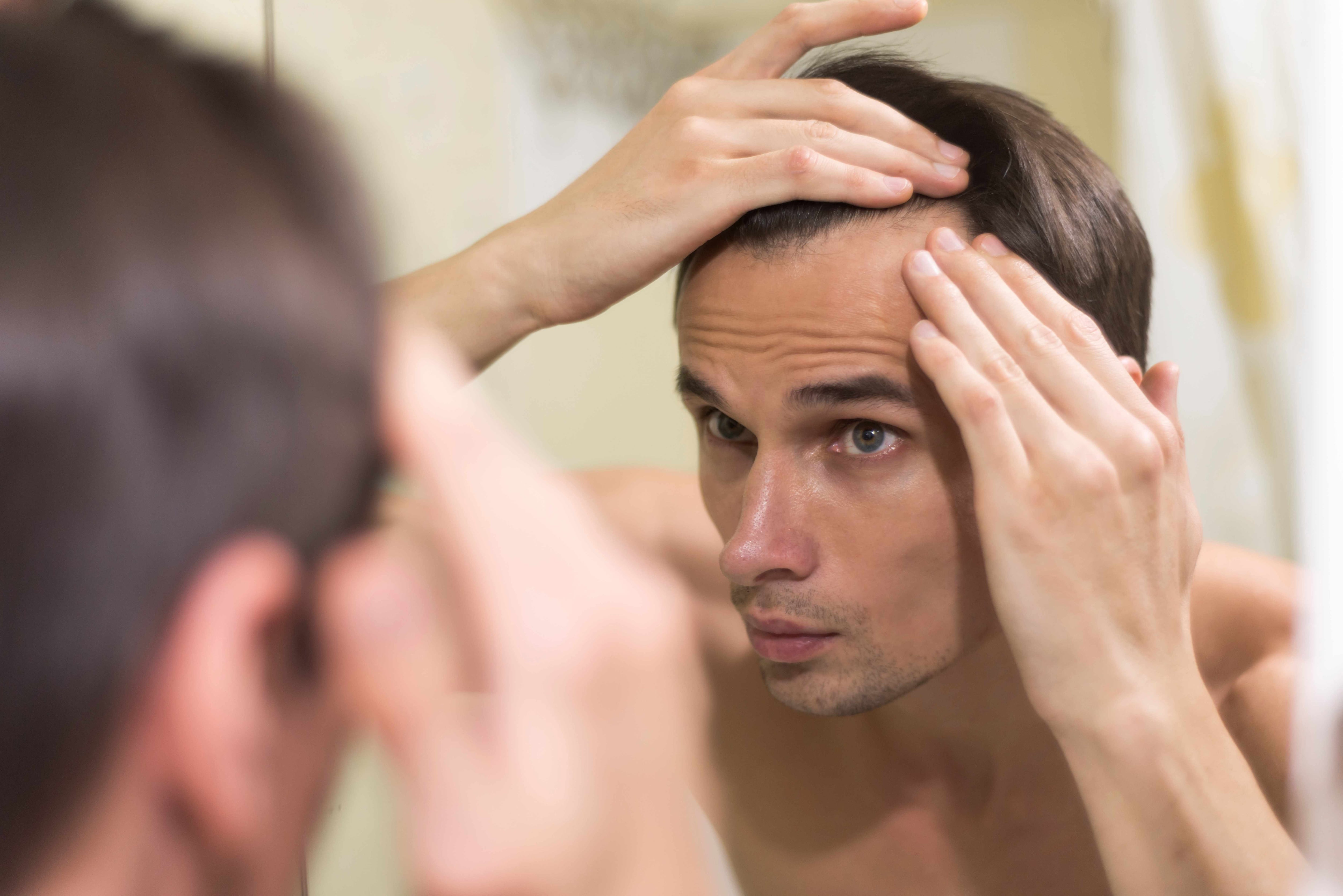 La caída del cabello en hombres suele tener origen genético, pero factores como el estrés, la alimentación y el mal cuidado capilar pueden acelerar el proceso.