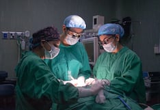 Arequipa: Médicos extirpan tumor de 10 centímetros y salvan a paciente con cáncer agresivo de tiroides