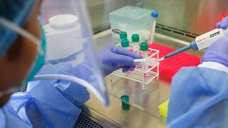 EsSalud advierte nuevo aumento del porcentaje de positividad de COVID-19 en pruebas moleculares