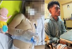 Chincha: su pareja no le respondió el celular y le desfigura el rostro a su hijastra de 2 años