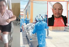 Chiclayo: mujer resulta herida tras ser empujada de mototaxi por ataque de su expareja