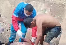 Huánuco: varón lucha por su vida tras sufrir graves quemaduras durante ataque con combustible y fuego