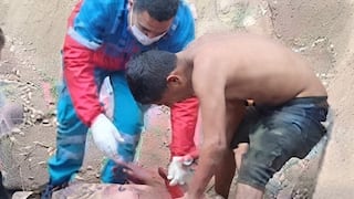 Huánuco: varón lucha por su vida tras sufrir graves quemaduras durante ataque con combustible y fuego