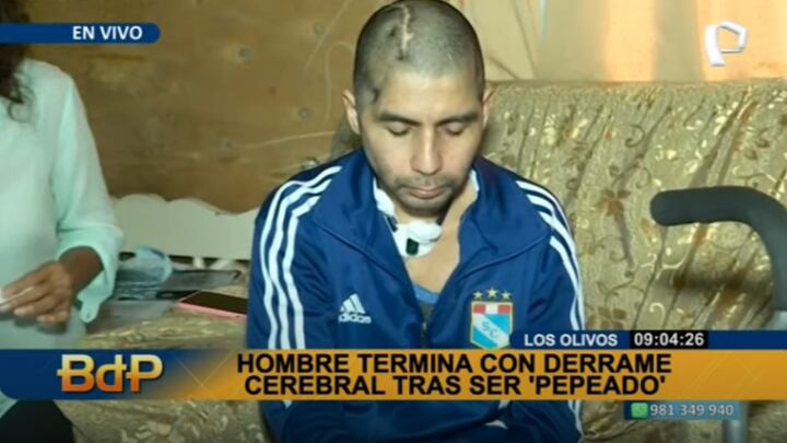 Hombre sufrió derrame tras ser 'pepeado'. Foto: Buenos Días Perú