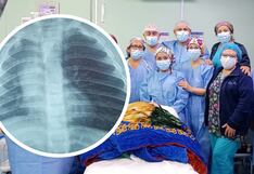 Salvan la vida de menor que se atragantó con un grano de tarwi en Cusco (VIDEO)