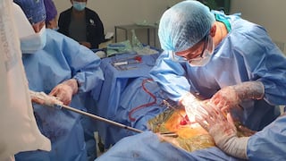 Médico huanca usa clips de titanio para reconstruir tórax de minero herido