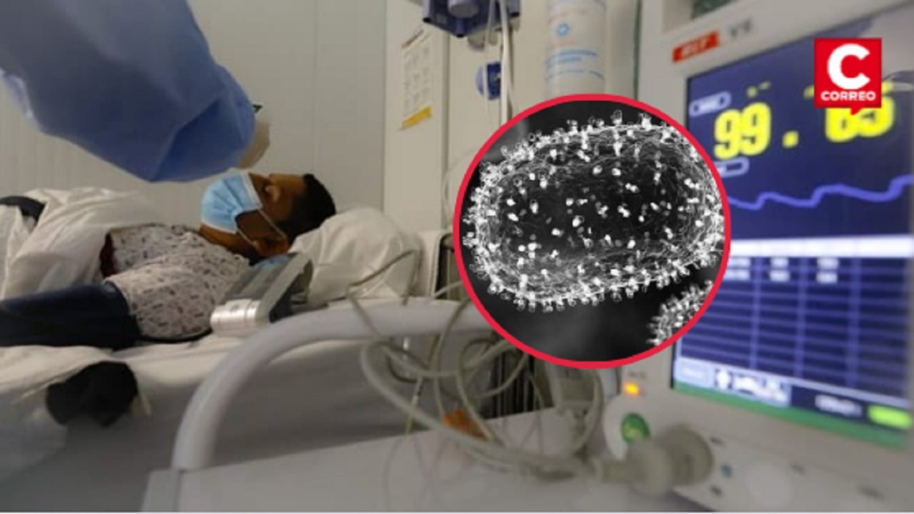 Así es el virus que causa la mpox visto en el microscopio. (Foto: Composición Minsa - SPL).